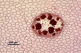 8 - Dettaglio di un soro di tetrasporocisti
